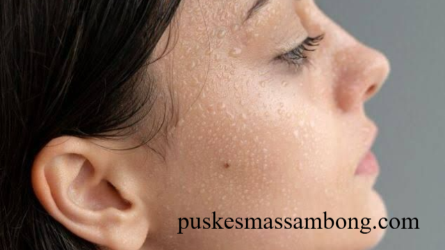 Mengatasi Keringat Berlebih di Wajah